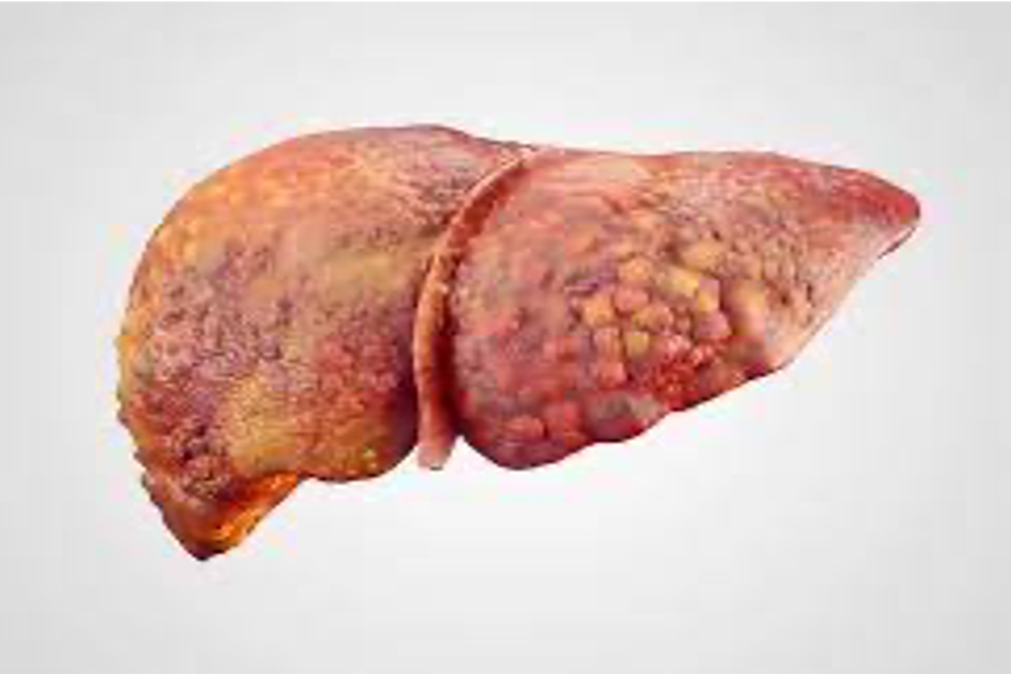 Chronic Liver 